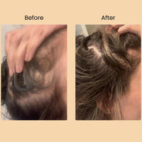 TRIO-CARE ESSENTIALS CAPSULES Halo Hair Co.