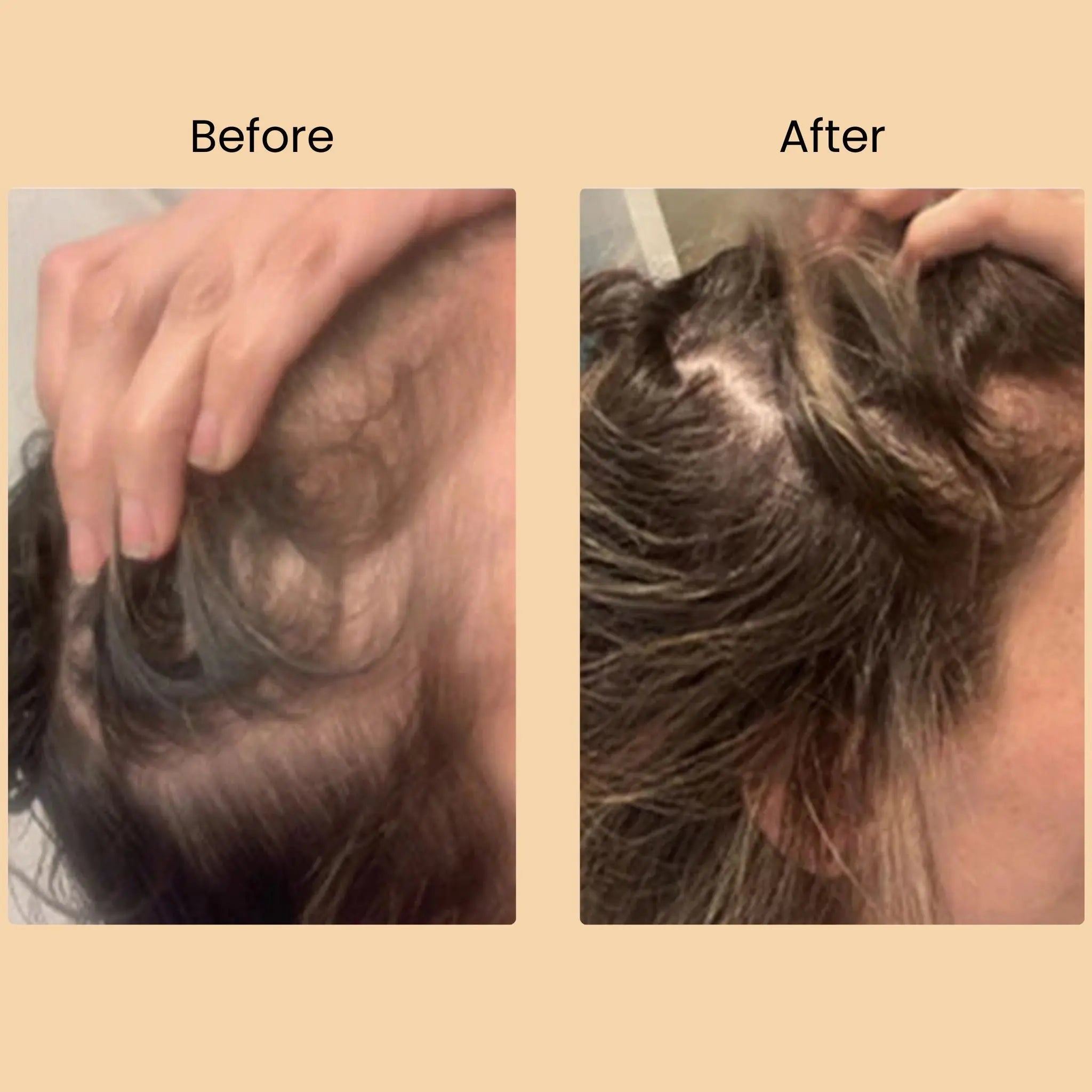 TRIO-CARE ESSENTIALS CAPSULES Halo Hair Co.