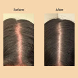 TRIO-CARE ESSENTIALS CAPSULES Halo Hair Co.