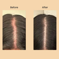 TRIO-CARE ESSENTIALS CAPSULES Halo Hair Co.