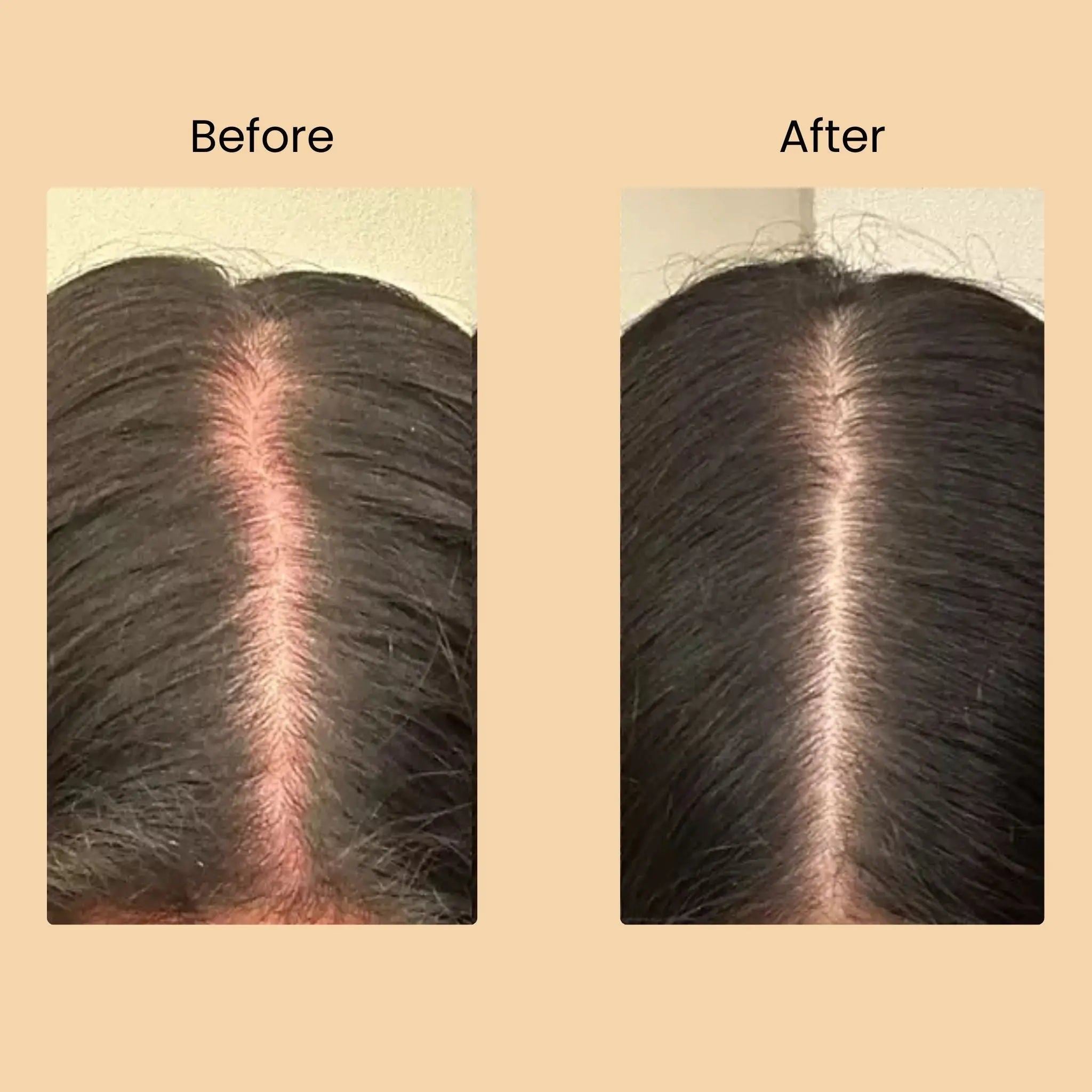 TRIO-CARE ESSENTIALS CAPSULES Halo Hair Co.