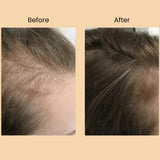 TRIO-CARE ESSENTIALS CAPSULES Halo Hair Co.