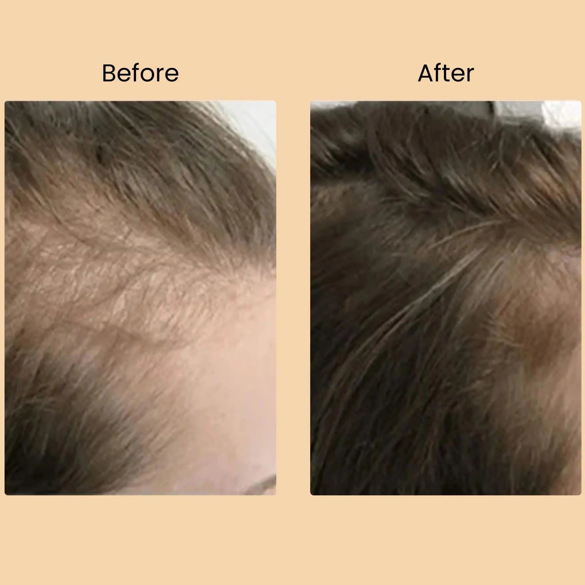 TRIO-CARE ESSENTIALS CAPSULES Halo Hair Co.